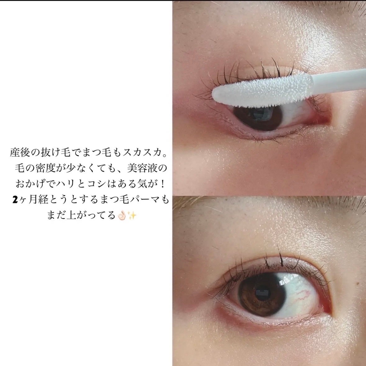 アトバリア365クリーム/AESTURA/フェイスクリームを使ったクチコミ(10枚目)