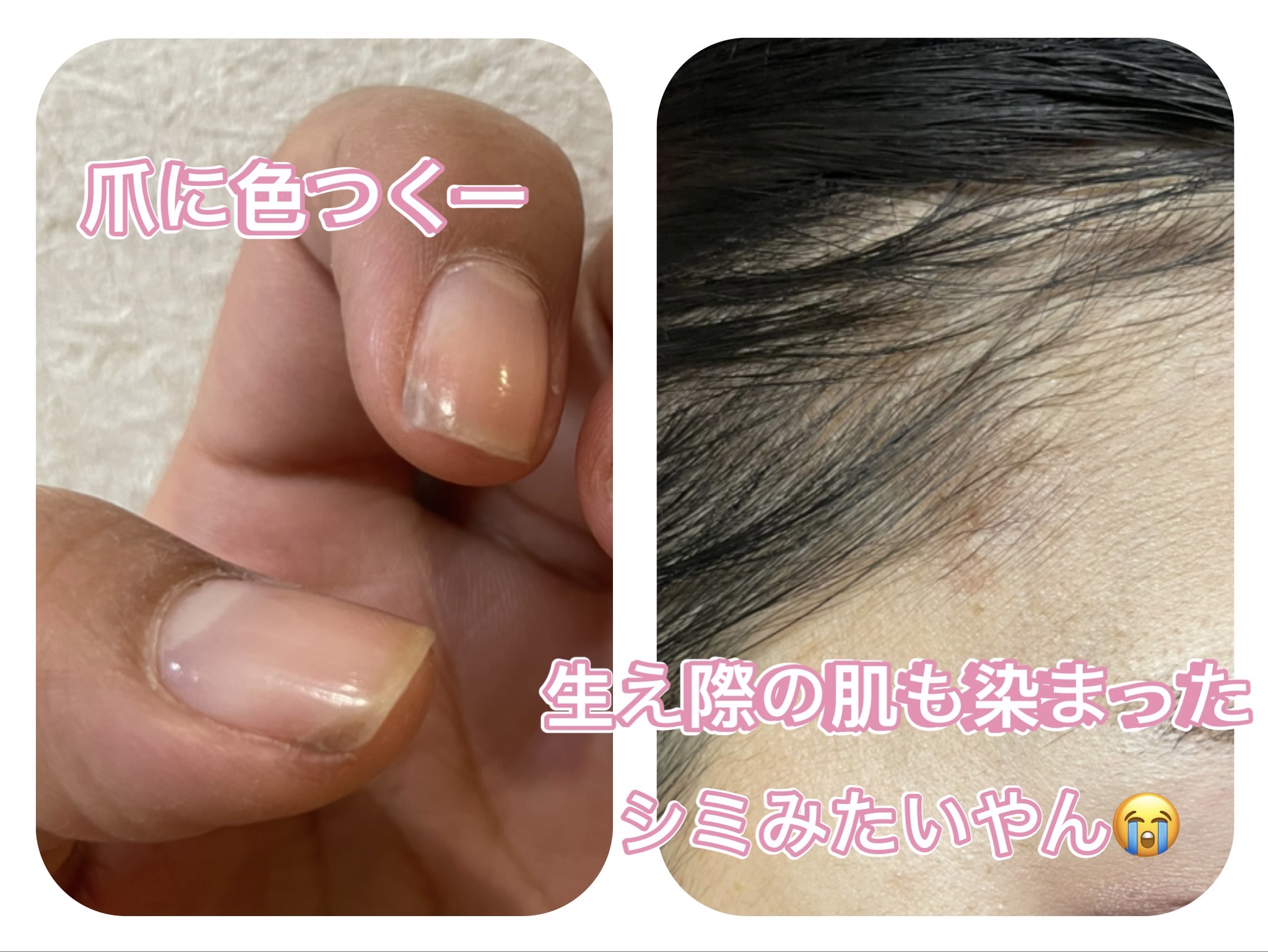 DHC Q10 プレミアム カラートリートメントのクチコミ「生え際にチラホラ白髪が気になるアラフォーです😭
美容院行くの面倒すぎて、ずっと地毛で過ごしてい.....」（2枚目）