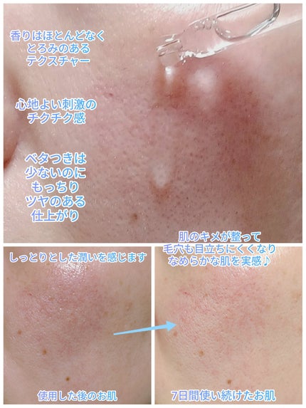 ダーメラ PDRNショット・毛穴アンプル/Dermela/美容液を使ったクチコミ(3枚目)