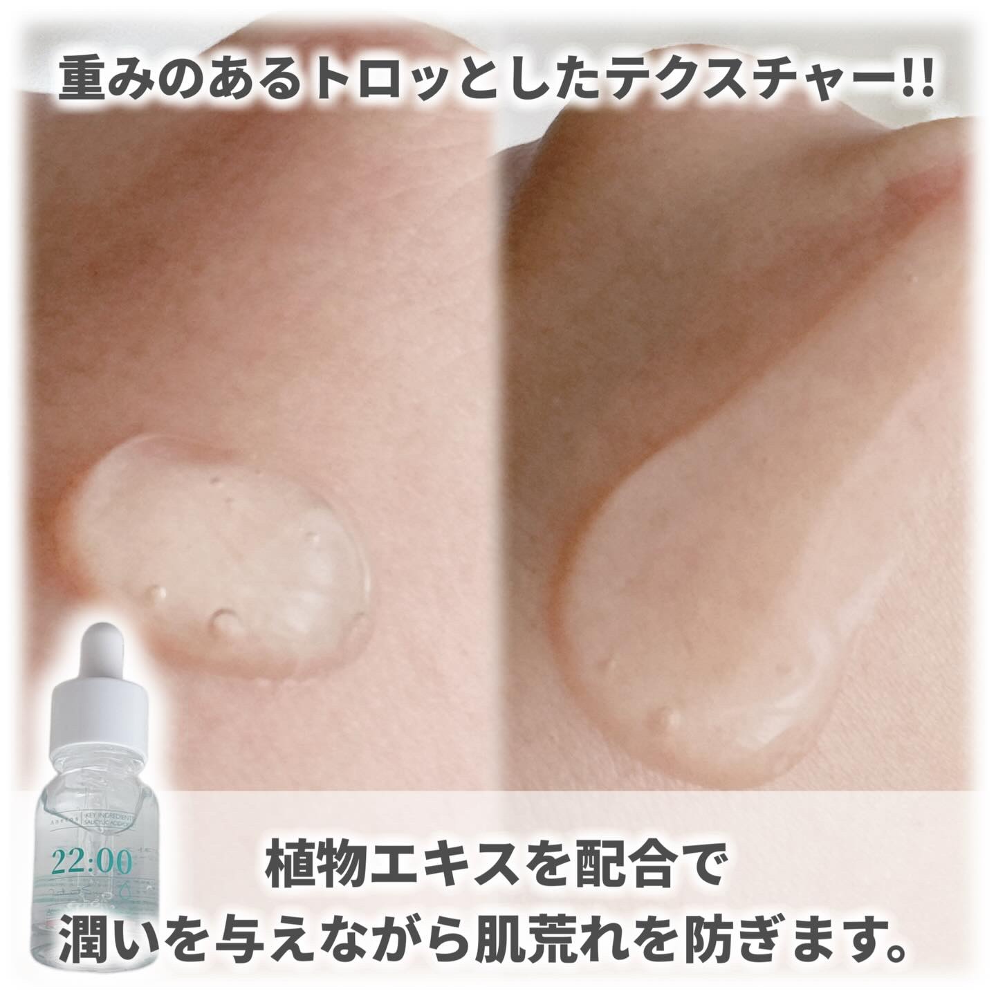 アネトス アクネケア トリートメント セラム/Anetos/美容液を使ったクチコミ（3枚目）