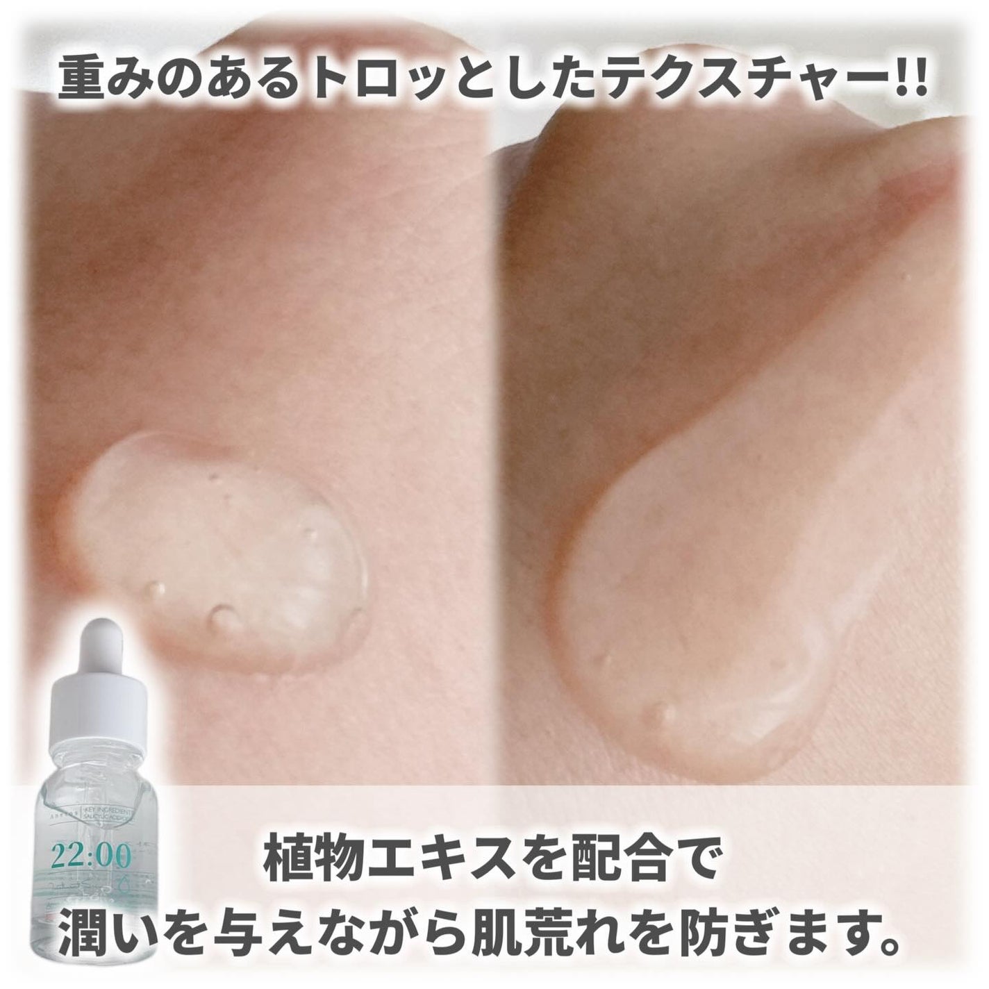 アネトス アクネケア トリートメント セラム/Anetos/美容液を使ったクチコミ(3枚目)