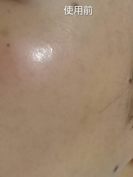 C×AZ ダーマインショット200/ESIENCE/美容液を使ったクチコミ(7枚目)