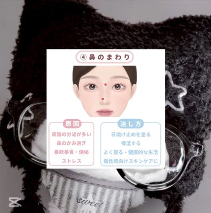 ðŽð°ðŽð°âðð.â on LIPS ã----------ä»åã¯ãããã«ã€ããŠã®åå ãšäºé²æ³ã®æ²»ãæ¹..ãïŒ5æç®ïŒ