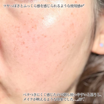 オーズナリージェットブルーセラム/オーズナリー/美容液を使ったクチコミ(5枚目)