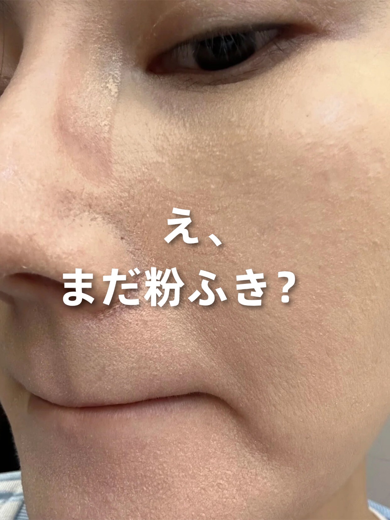 アネトス バランシング トリートメントクリーム/Anetos/フェイスクリームを使ったクチコミ（1枚目）