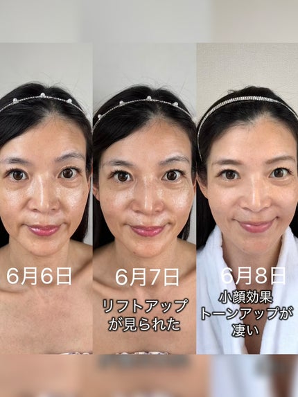 リフト美顔器/ANLAN/美顔器・マッサージを使ったクチコミ(4枚目)