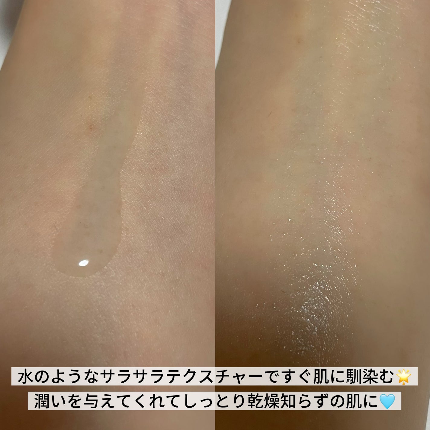 レッドブレミッシュ クリアヒアルシカスージングセラム/Dr.G/美容液を使ったクチコミ(2枚目)