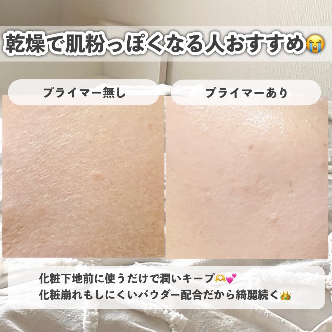 サンリットパール プランパー 02 ローズオパール/tilnus/リッププランパーを使ったクチコミ（3枚目）