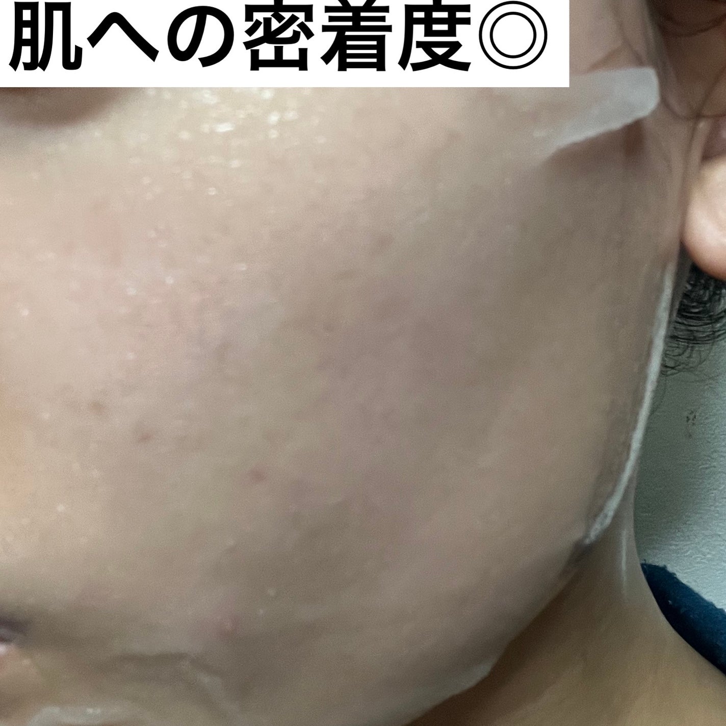 ダーマレーザースーパーVC100マスク/クオリティファースト/シートマスク・パックを使ったクチコミ(4枚目)