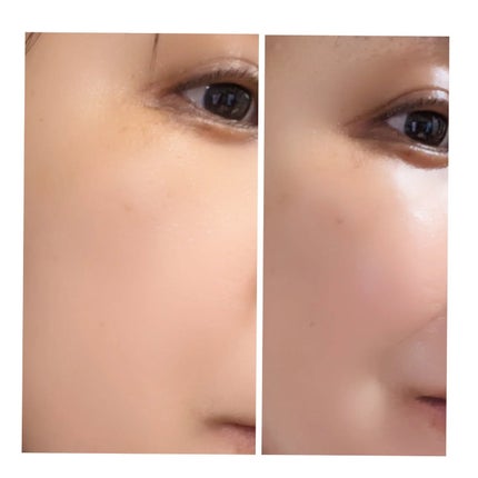 C×AZ ダーマインショット200/ESIENCE/美容液を使ったクチコミ(4枚目)