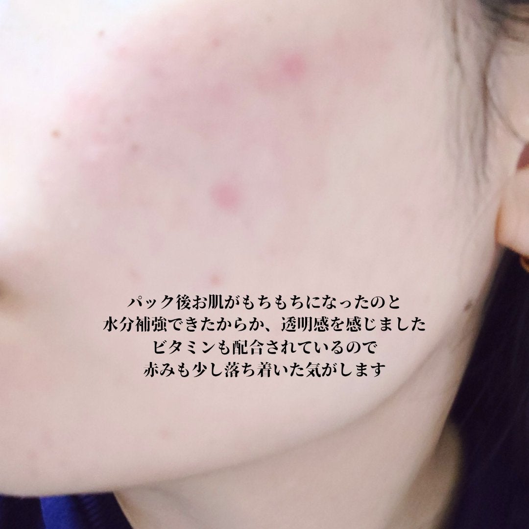 ビタチノールセラム メガショット ゲルマスク/primera/シートマスク・パックを使ったクチコミ(7枚目)