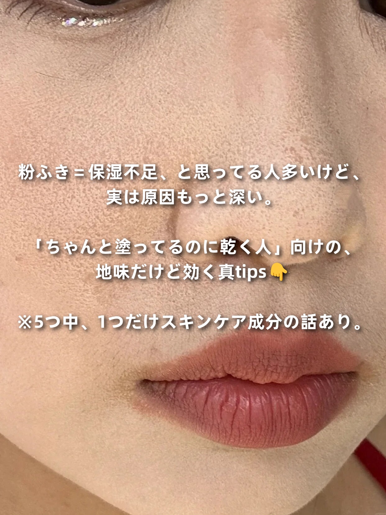 アネトス バランシング トリートメントクリーム/Anetos/フェイスクリームを使ったクチコミ（2枚目）