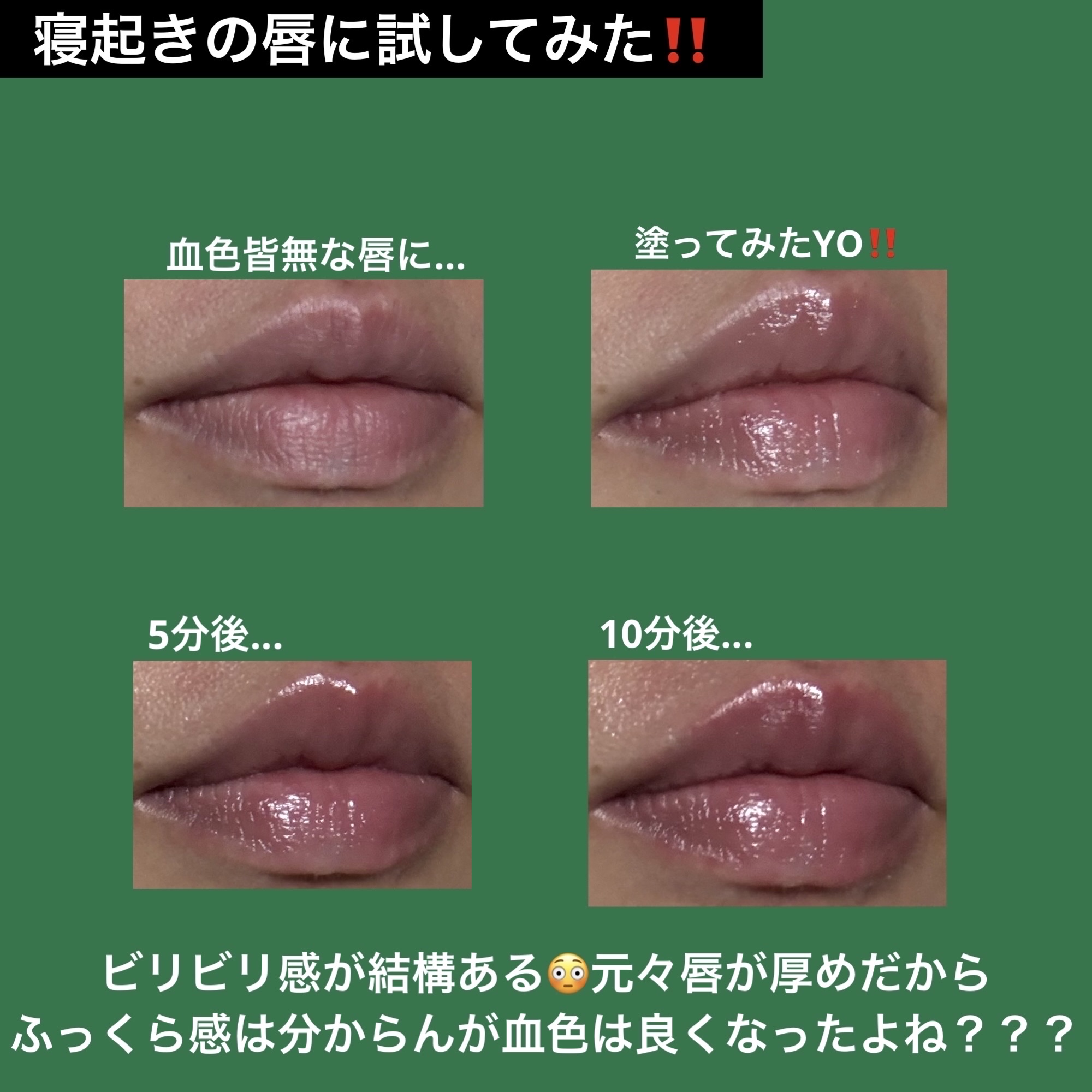 チャミスルリッププランパー フレッシュ/SHOBIDO/リッププランパーを使ったクチコミ（2枚目）