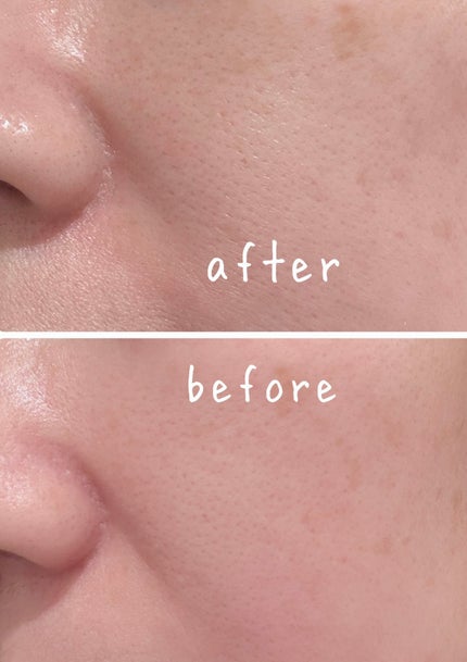 C×AZ ダーマインショット200/ESIENCE/美容液を使ったクチコミ(3枚目)