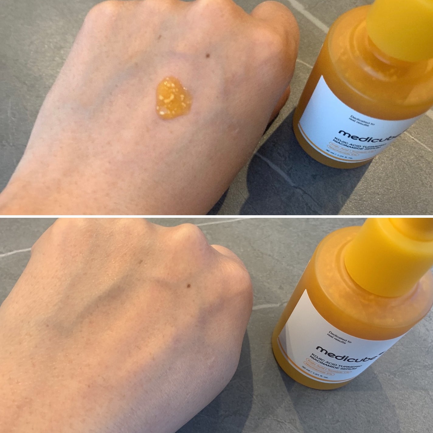 コウジ酸ビタナイアシンセラム/MEDICUBE/美容液を使ったクチコミ(2枚目)