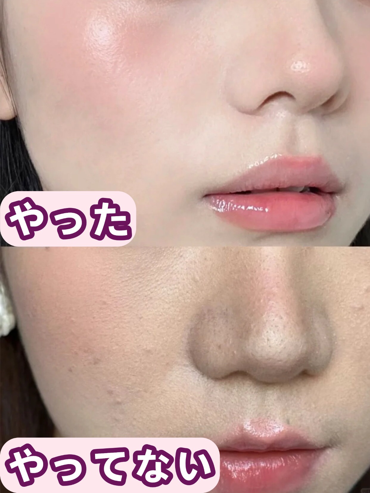 アネトス バランシング トリートメントクリーム/Anetos/フェイスクリームを使ったクチコミ（1枚目）