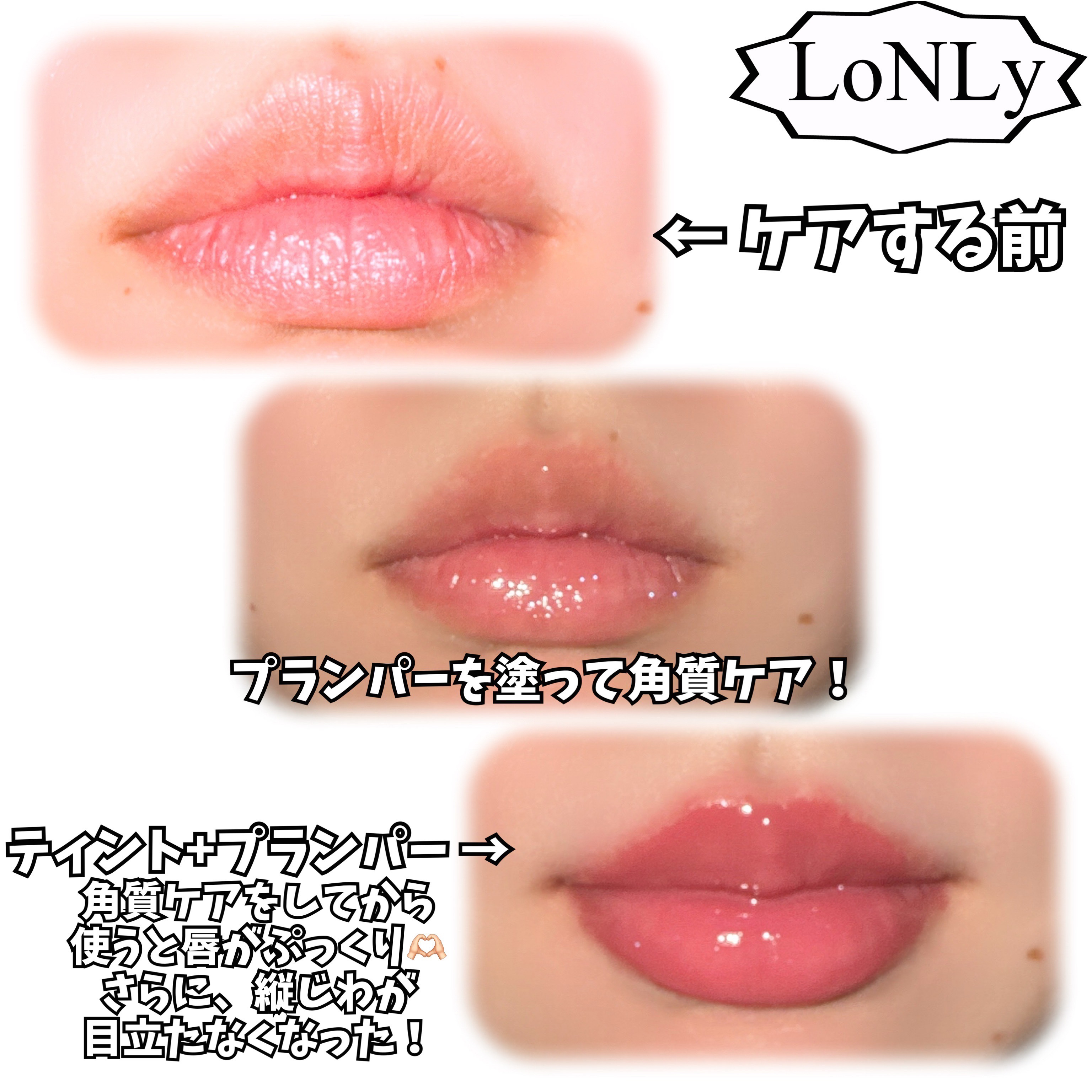 フレイムライトリッププランパー/LoNLy /リッププランパーを使ったクチコミ（3枚目）