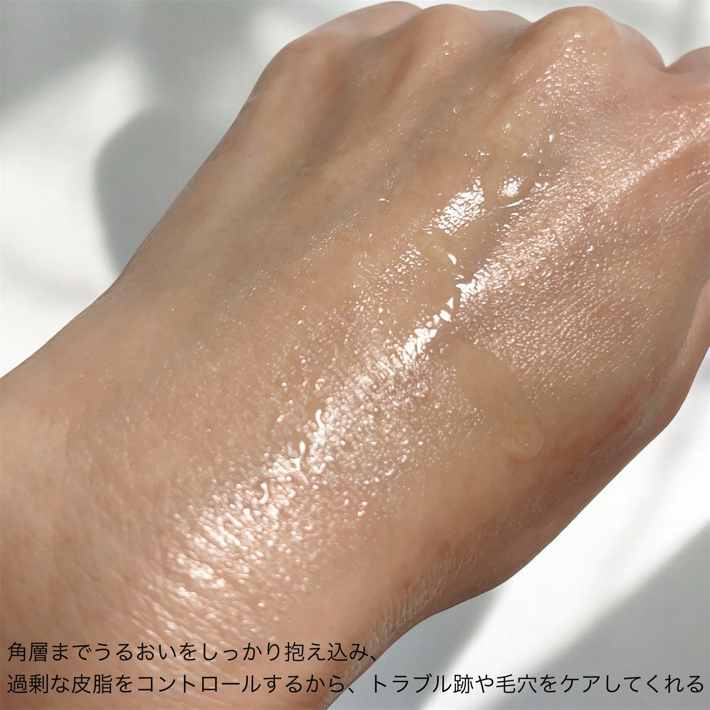 アゼライン酸CICA37セラム/オーズナリー/美容液を使ったクチコミ(4枚目)