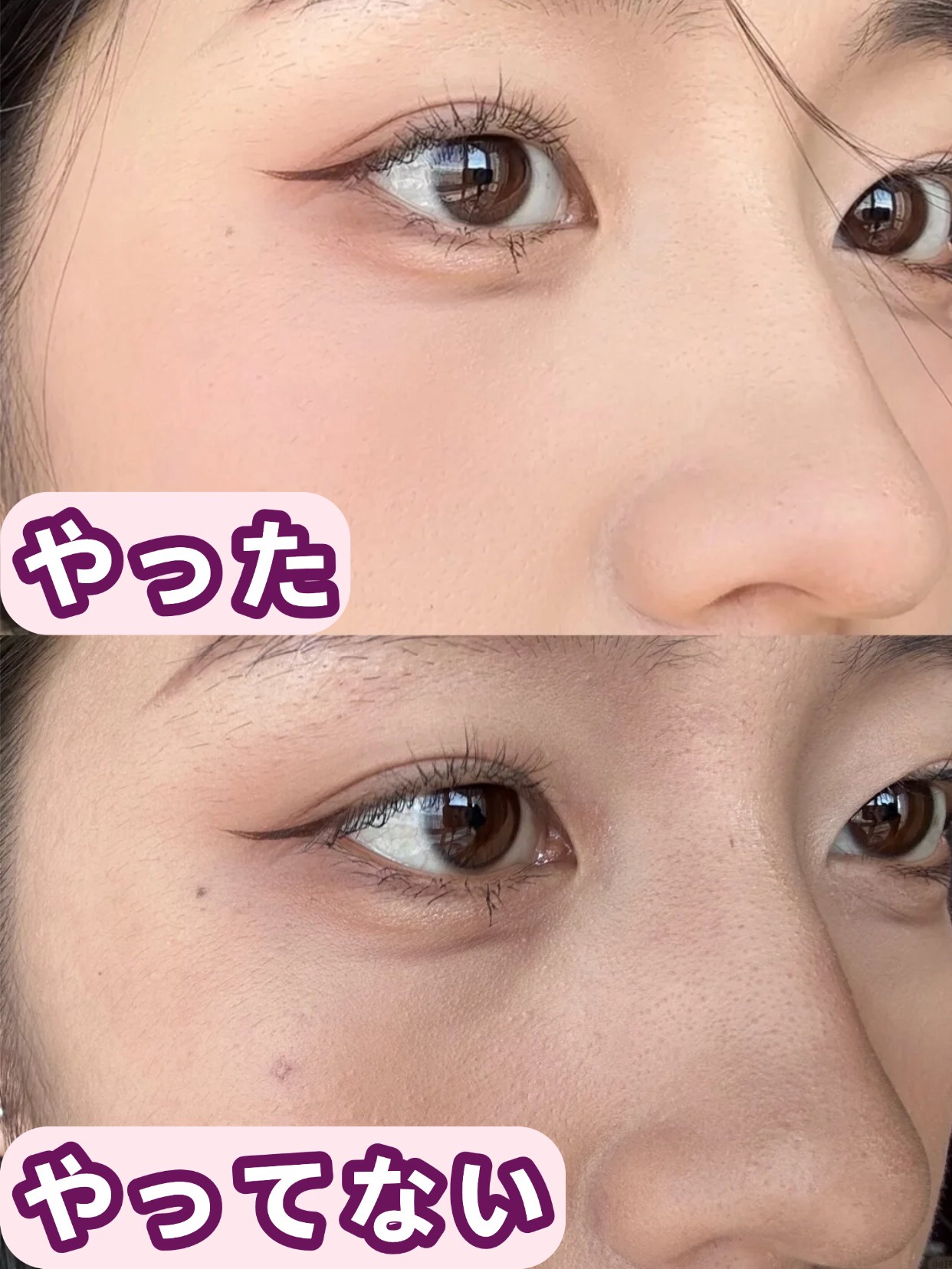 アネトス バランシング トリートメントクリーム/Anetos/フェイスクリームを使ったクチコミ（1枚目）