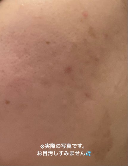 レチノール 3ペプチドナイトリペアクリーム/Anua/フェイスクリームを使ったクチコミ(1枚目)