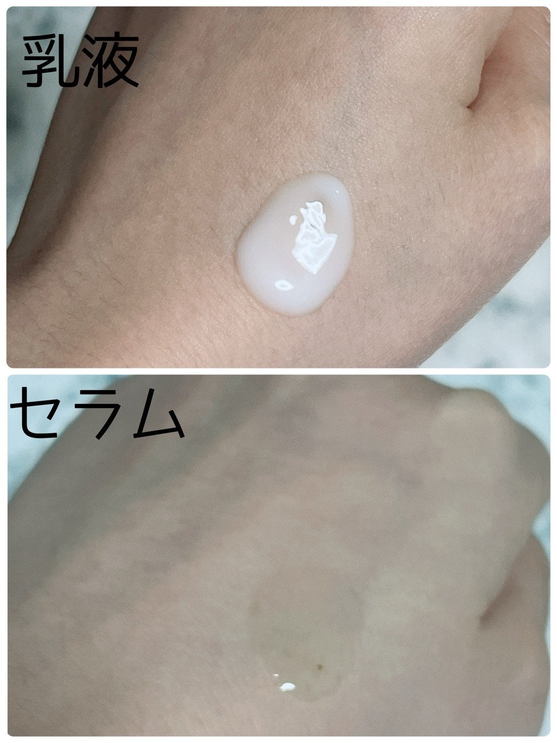 アゼライン酸15 インテンスカーミングセラム/Anua/美容液を使ったクチコミ(2枚目)