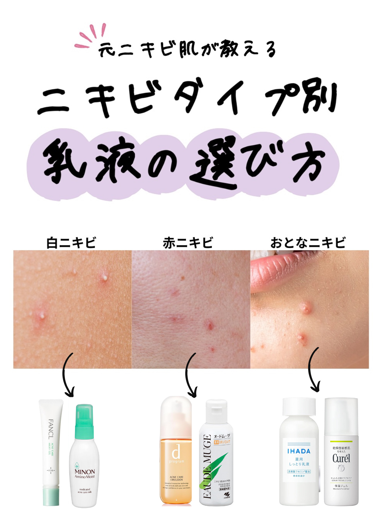 皮脂トラブルケア 保湿ジェル/キュレル/化粧水を使ったクチコミ（1枚目）