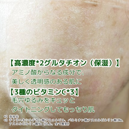 サボリーノ メガショット 夜用白玉タイトニングマスクV/サボリーノ/シートマスク・パックを使ったクチコミ(2枚目)