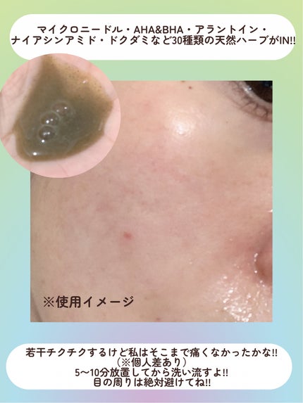 ハーブピーリング/on:myskin/ピーリングを使ったクチコミ(4枚目)