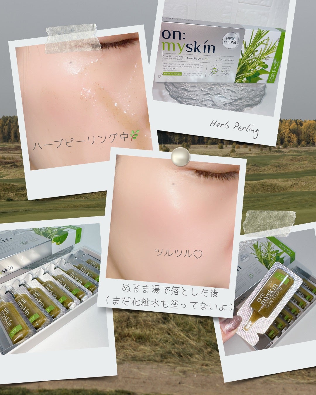 ハーブピーリング/on:myskin/ピーリングを使ったクチコミ(2枚目)