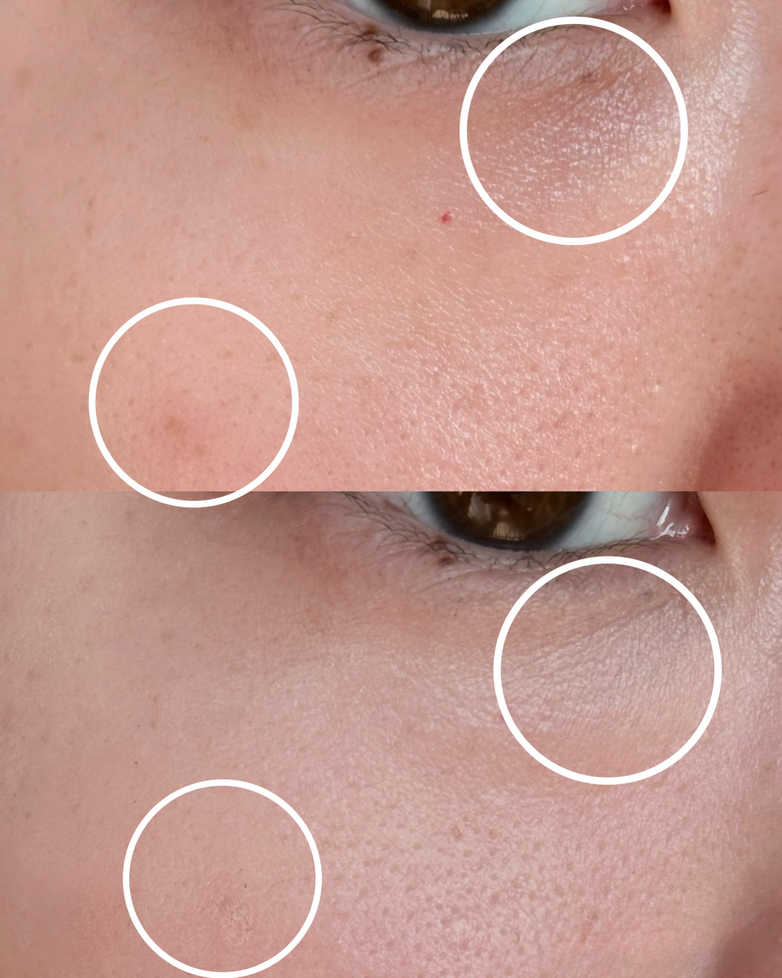 カバーアッププロコンシーラー/TFIT/パレットコンシーラーを使ったクチコミ（3枚目）