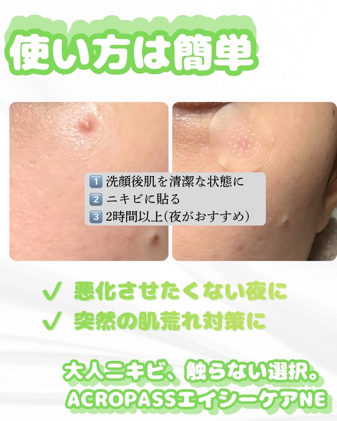 エイシーケアNE/ACROPASS/その他スキンケアを使ったクチコミ(4枚目)