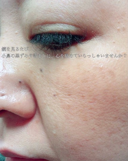 ブラックジェルクレンジング/.akaran/クレンジングジェルを使ったクチコミ(3枚目)