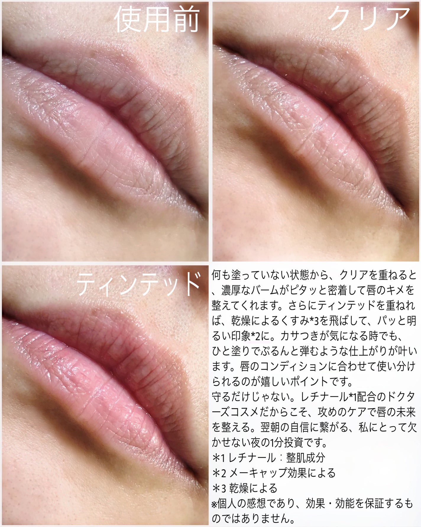 レチナールリップバーム/Dr.Different/リップバームを使ったクチコミ(4枚目)