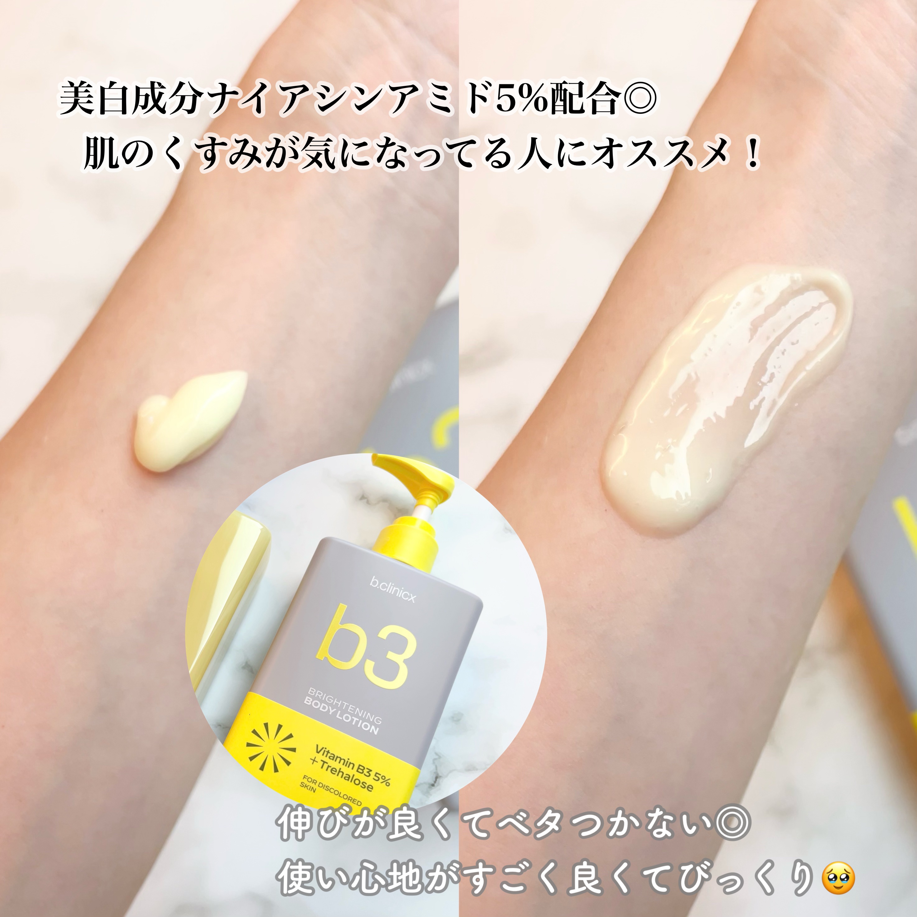 ナイアシンアミド 5% ボディローション/b.clinicx/ボディローションを使ったクチコミ（3枚目）