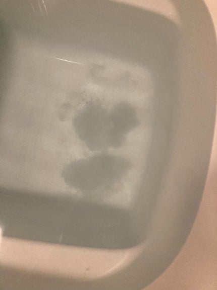 薬用 bath aid/ホコニコ/炭酸系入浴剤を使ったクチコミ(5枚目)