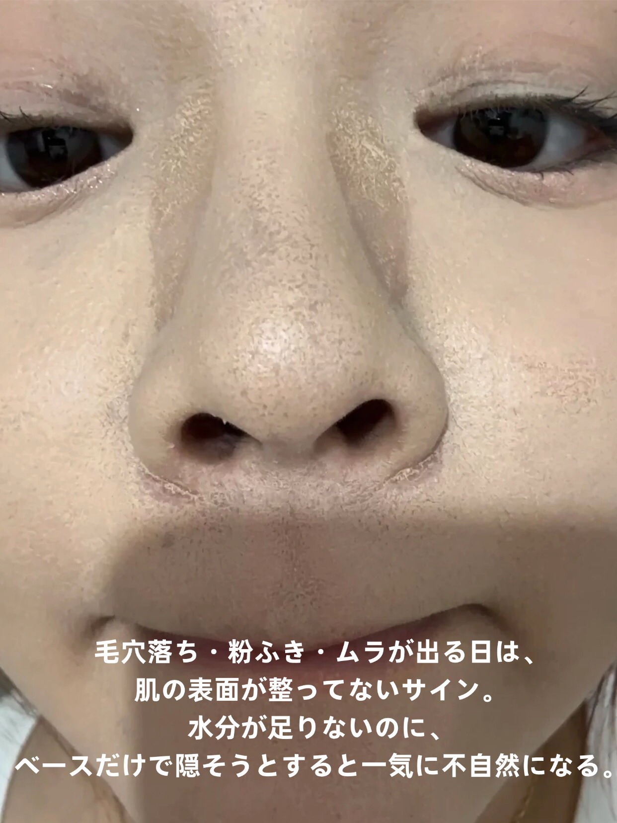 アネトス バランシング トリートメントクリーム/Anetos/フェイスクリームを使ったクチコミ（3枚目）