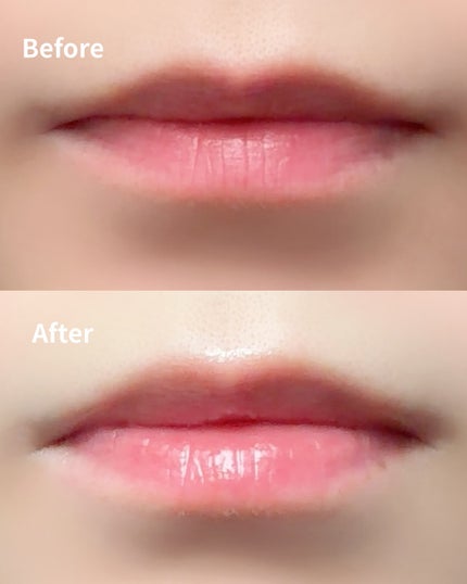 キューミ―ボムショットリッププランパー/AGARISM/リッププランパーを使ったクチコミ(4枚目)