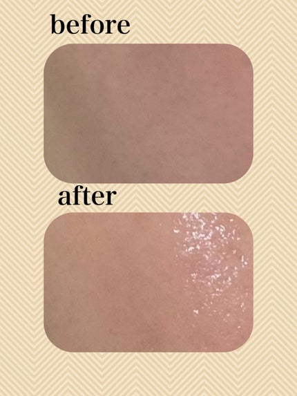 グルタチオン トーンオンセラム/VT/美容液を使ったクチコミ(7枚目)