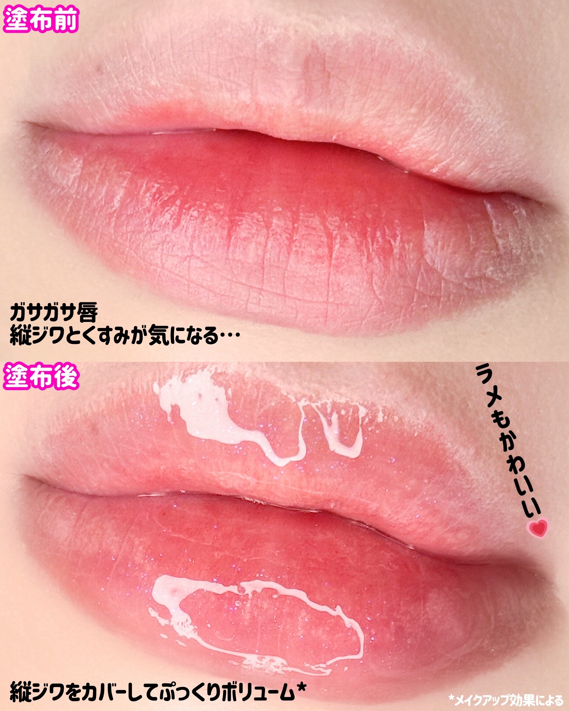 フレイムライトリッププランパー/LoNLy /リッププランパーを使ったクチコミ（2枚目）