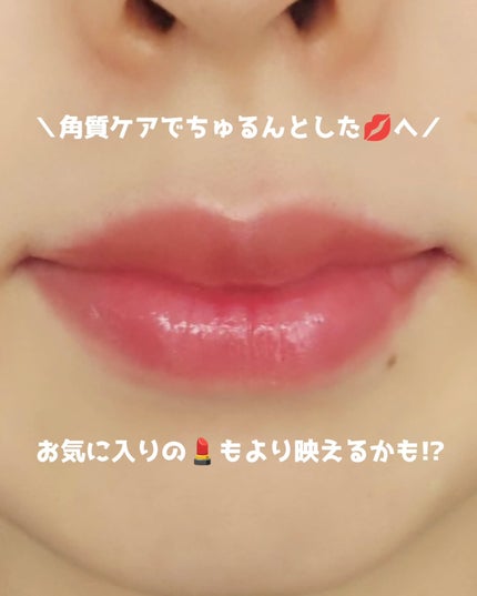 フレイムライトリッププランパー/LoNLy /リッププランパーを使ったクチコミ(2枚目)