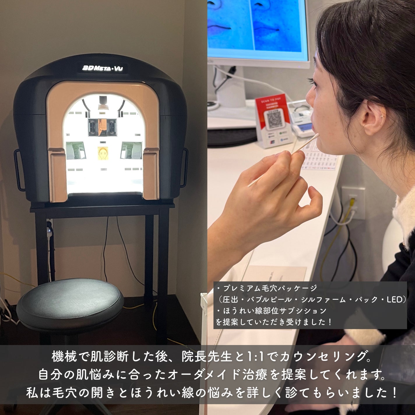 tobibi on LIPS 「1:1のオーダメイド治療で肌悩み解決/THESINSACLIN..」(3枚目)