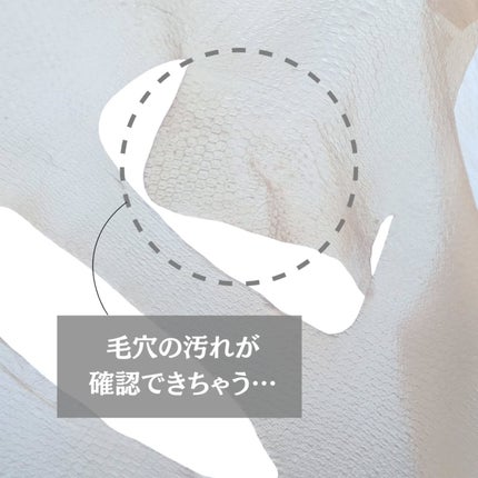 トラブルパッチマスク/EIOM/その他スキンケアを使ったクチコミ(4枚目)