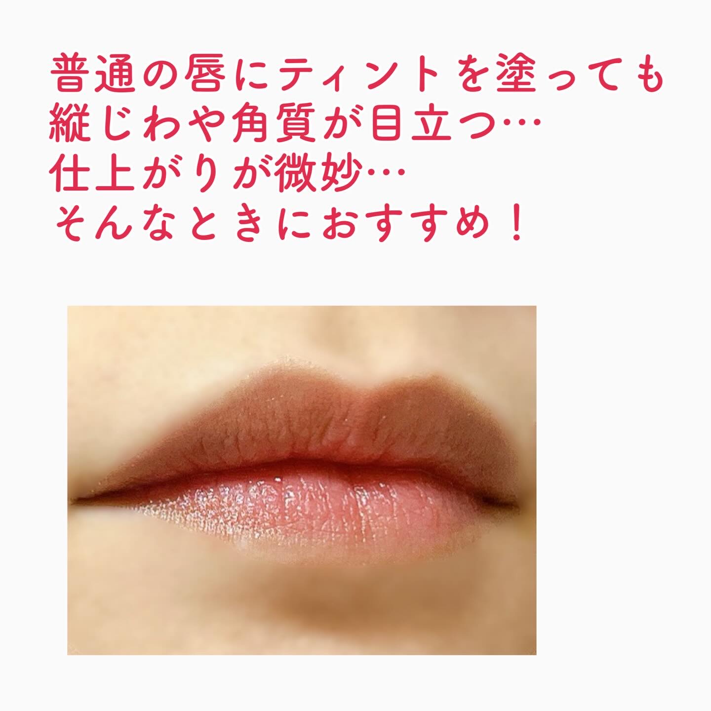 フレイムライトリッププランパー/LoNLy /リッププランパーを使ったクチコミ（2枚目）