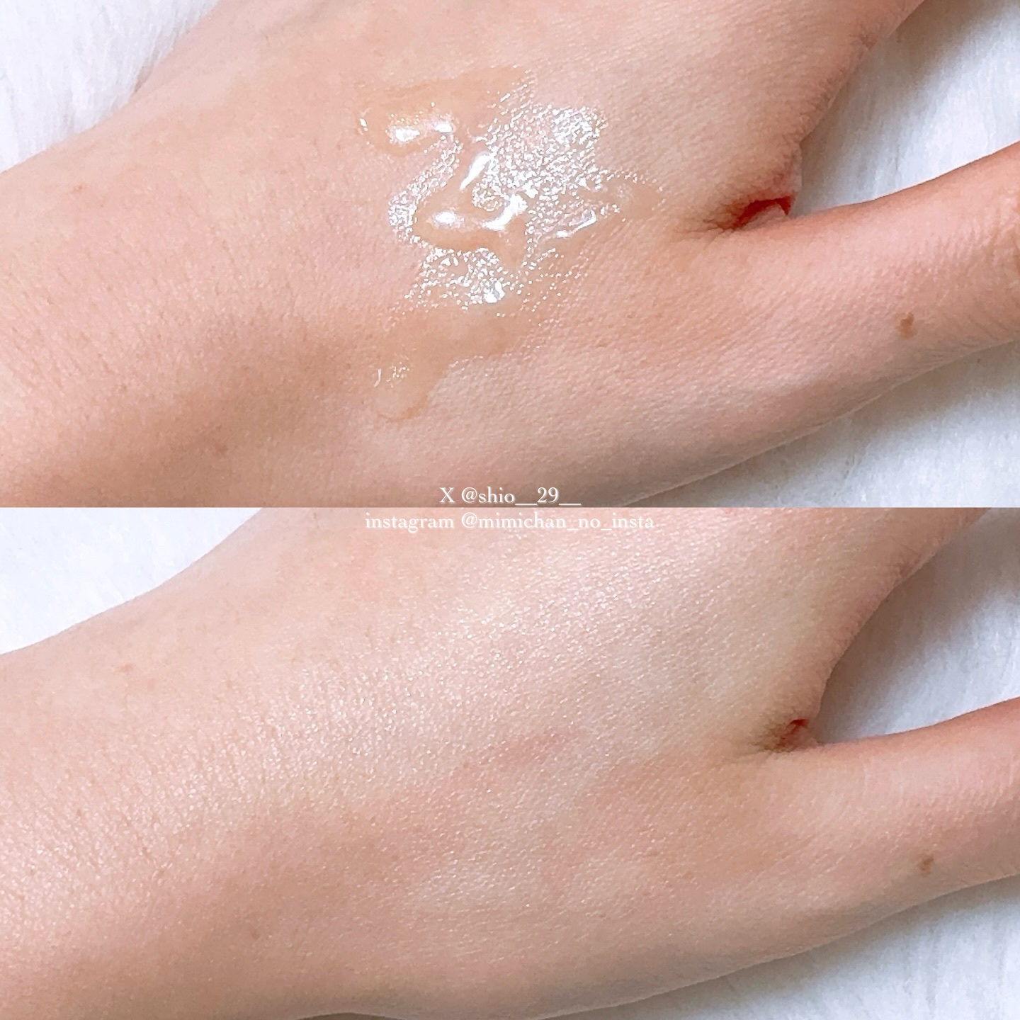 アゼライン酸CICA37セラム/オーズナリー/美容液を使ったクチコミ（3枚目）