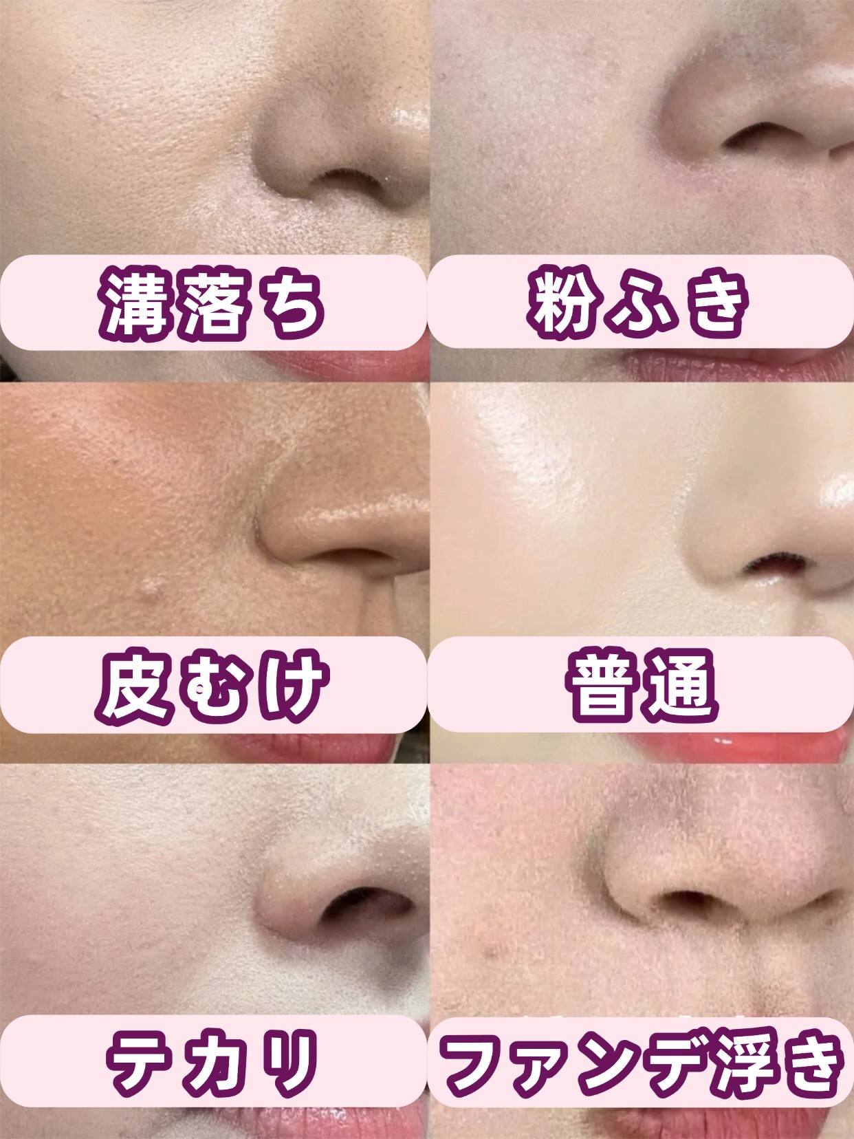 アネトス バランシング トリートメントクリーム/Anetos/フェイスクリームを使ったクチコミ（1枚目）