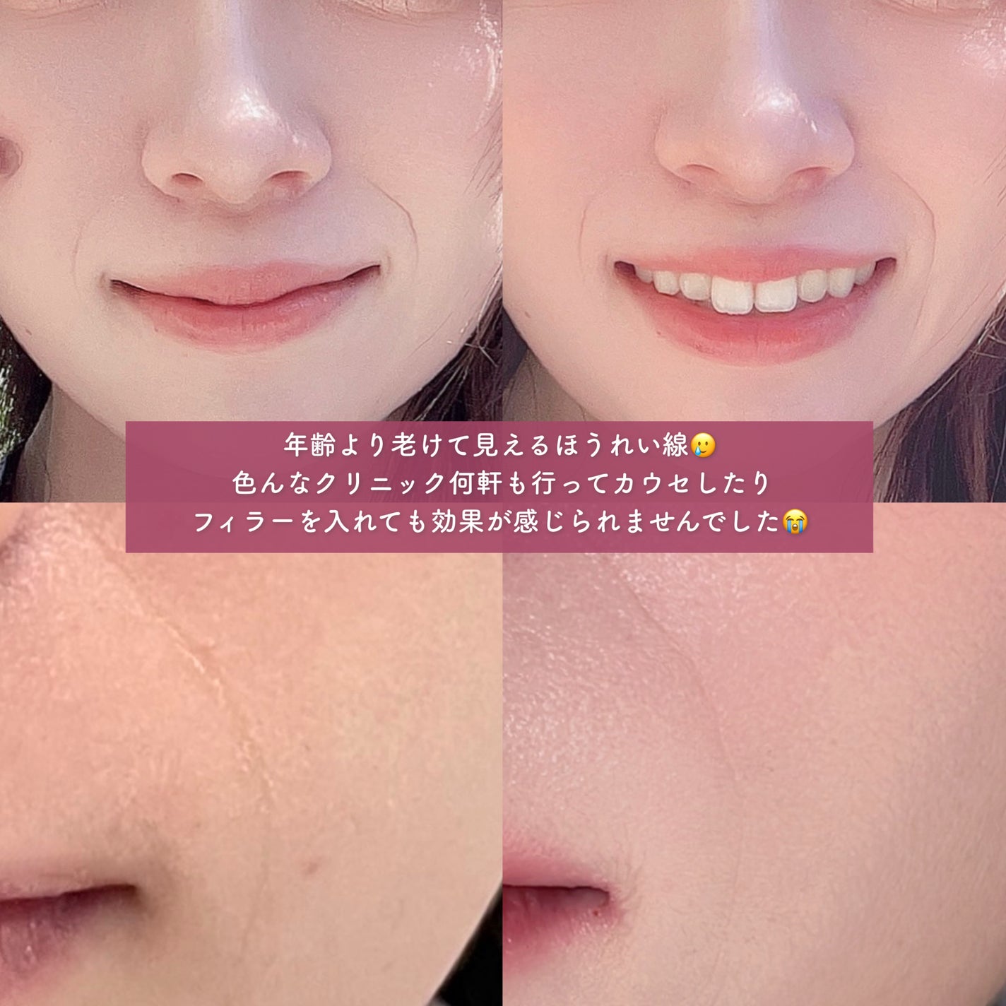 tobibi on LIPS 「1:1のオーダメイド治療で肌悩み解決/THESINSACLIN..」(6枚目)