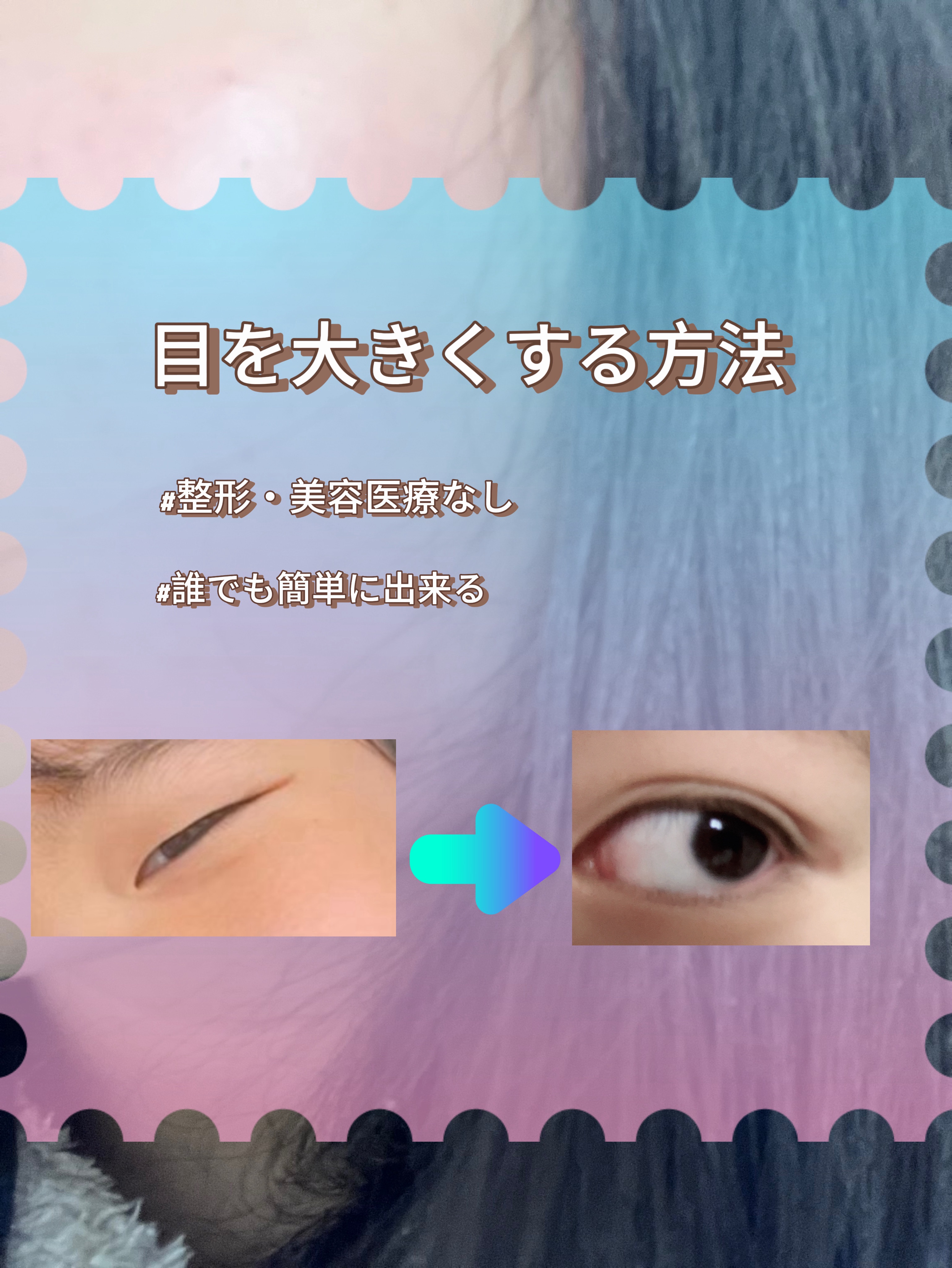 のびーるアイテープ（絆創膏タイプ、レギュラー） 70枚/DAISO/二重まぶた用アイテムを使ったクチコミ（1枚目）