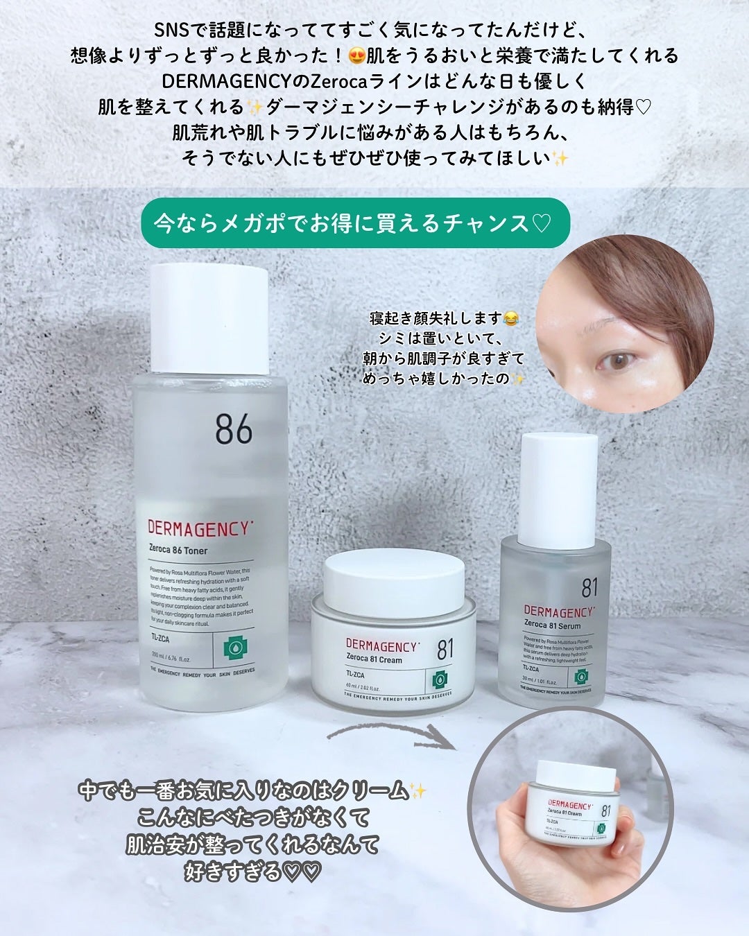 ダーマジェンシー ゼロカ86 トナー/DERMAGENCY/化粧水を使ったクチコミ(5枚目)