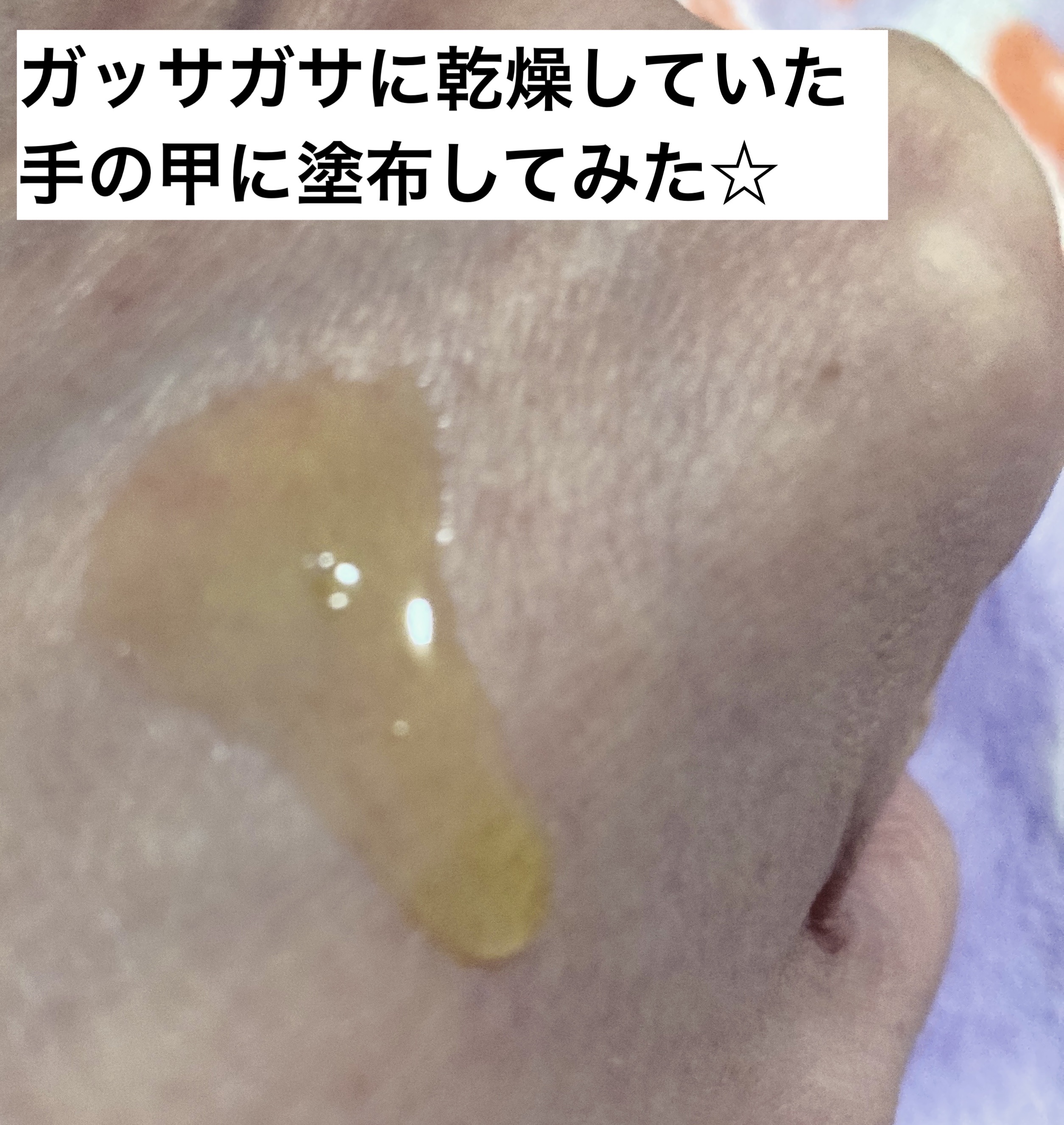 Remedies Five/イムノカーサ/美容液を使ったクチコミ（2枚目）