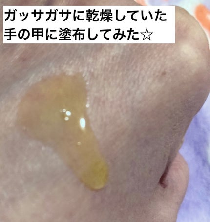 Remedies Five/イムノカーサ/美容液を使ったクチコミ(2枚目)